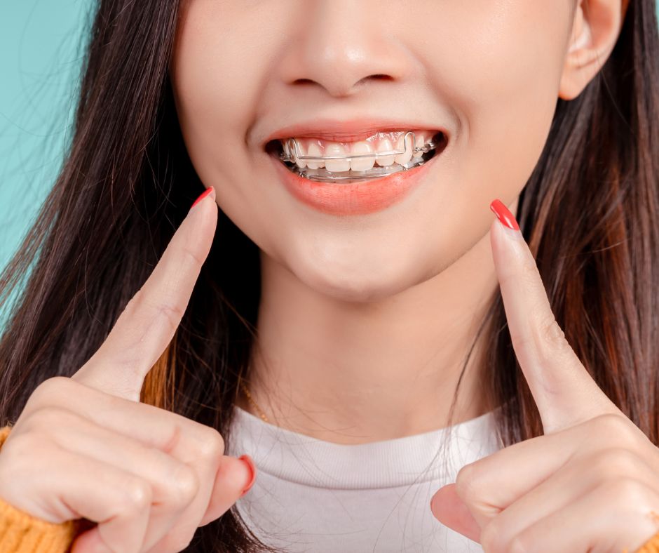 after braces care
